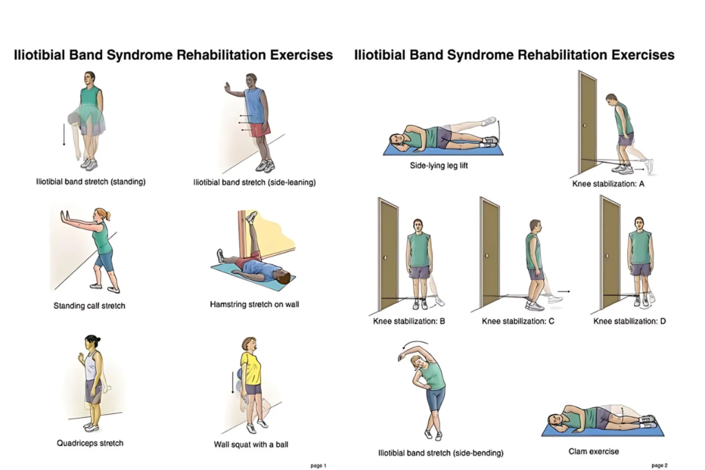 You Should Know About The Trochanteric Bursitis Exercises